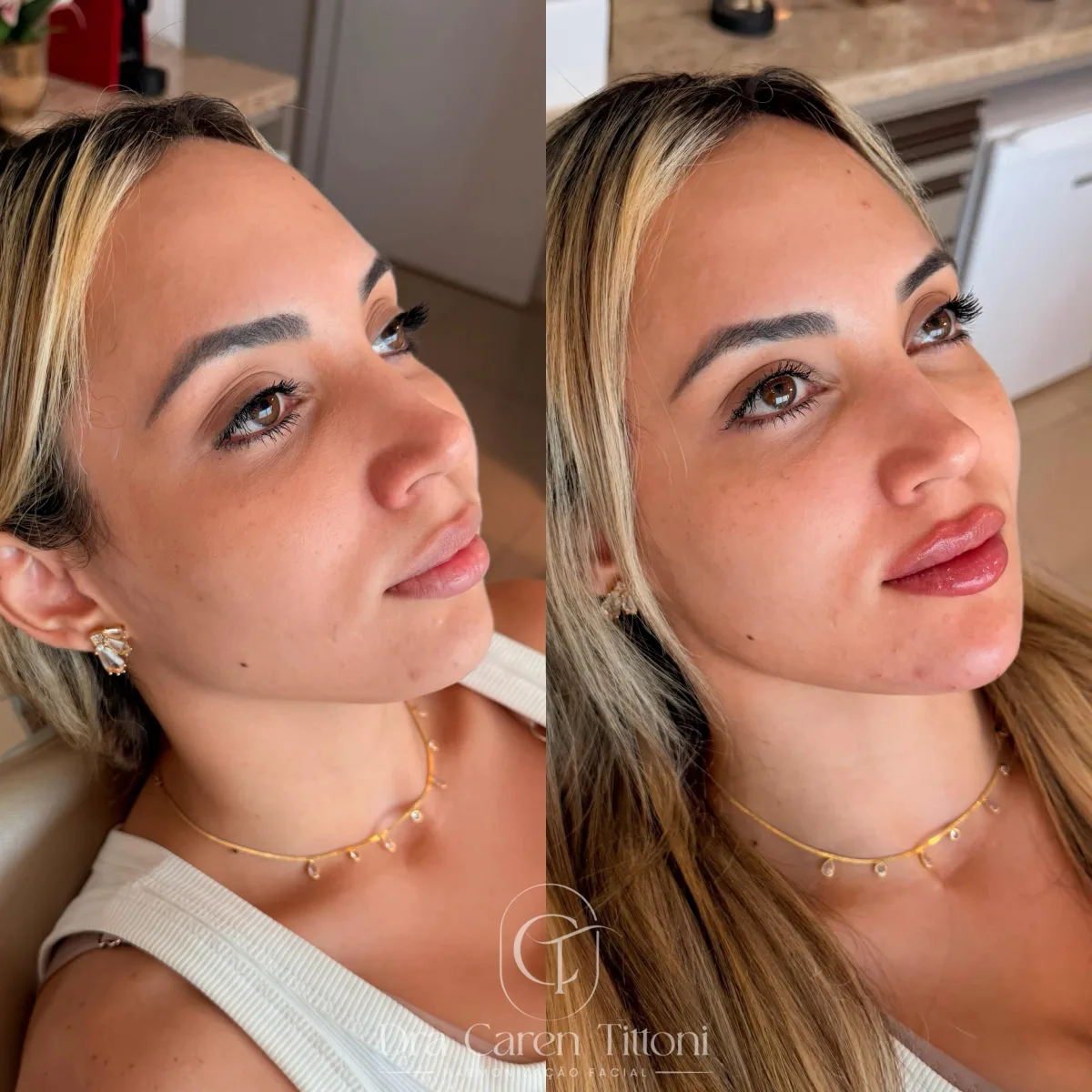 Ela já era muito bonita