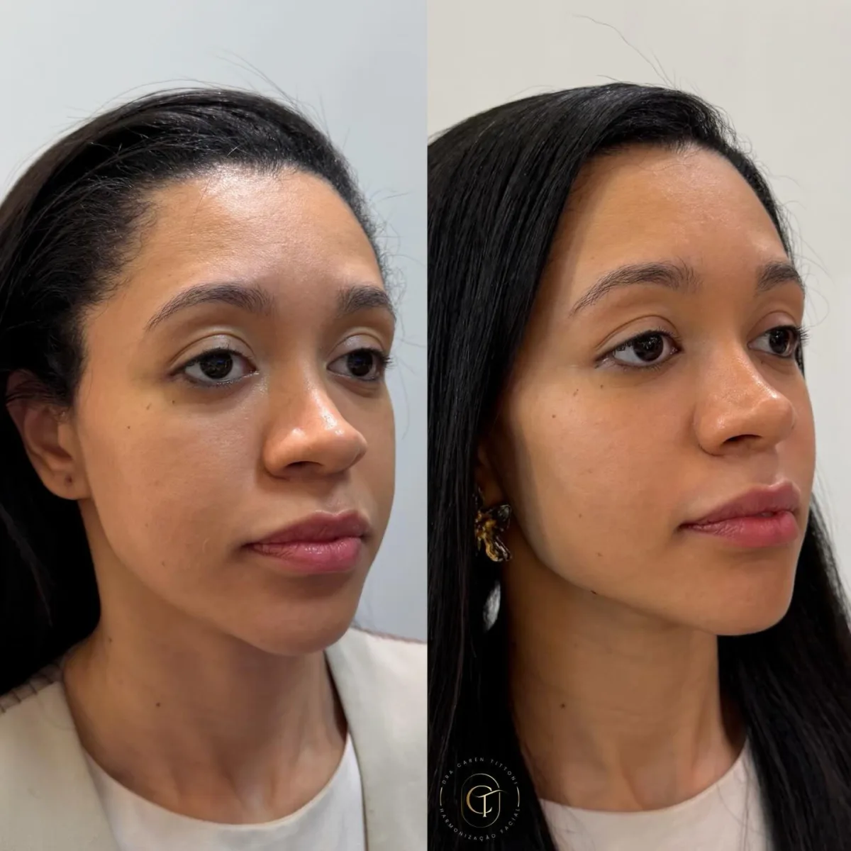 Beleza realçada com naturalidade