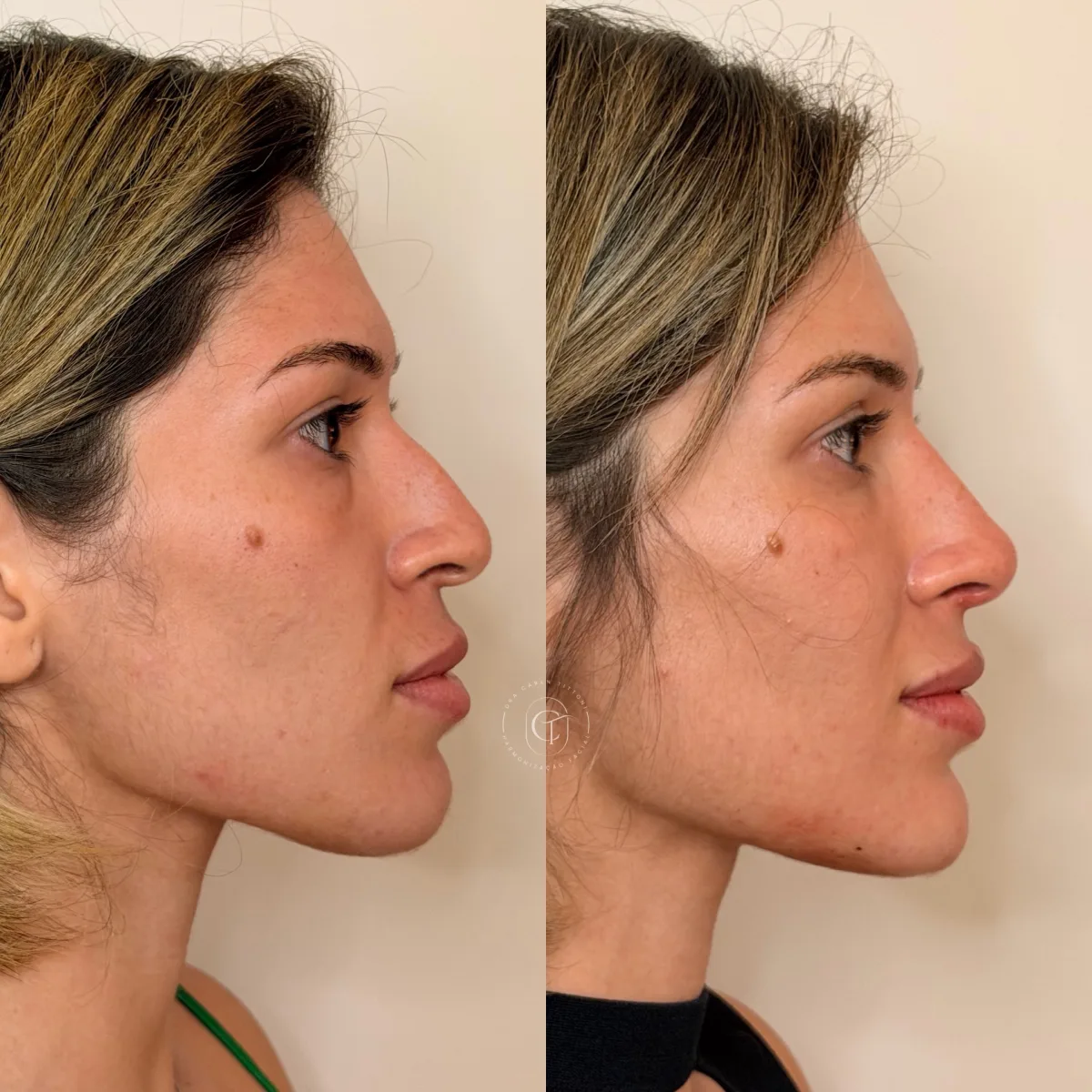 Cada detalhe faz diferença quando o objetivo é um resultado natural e harmonioso