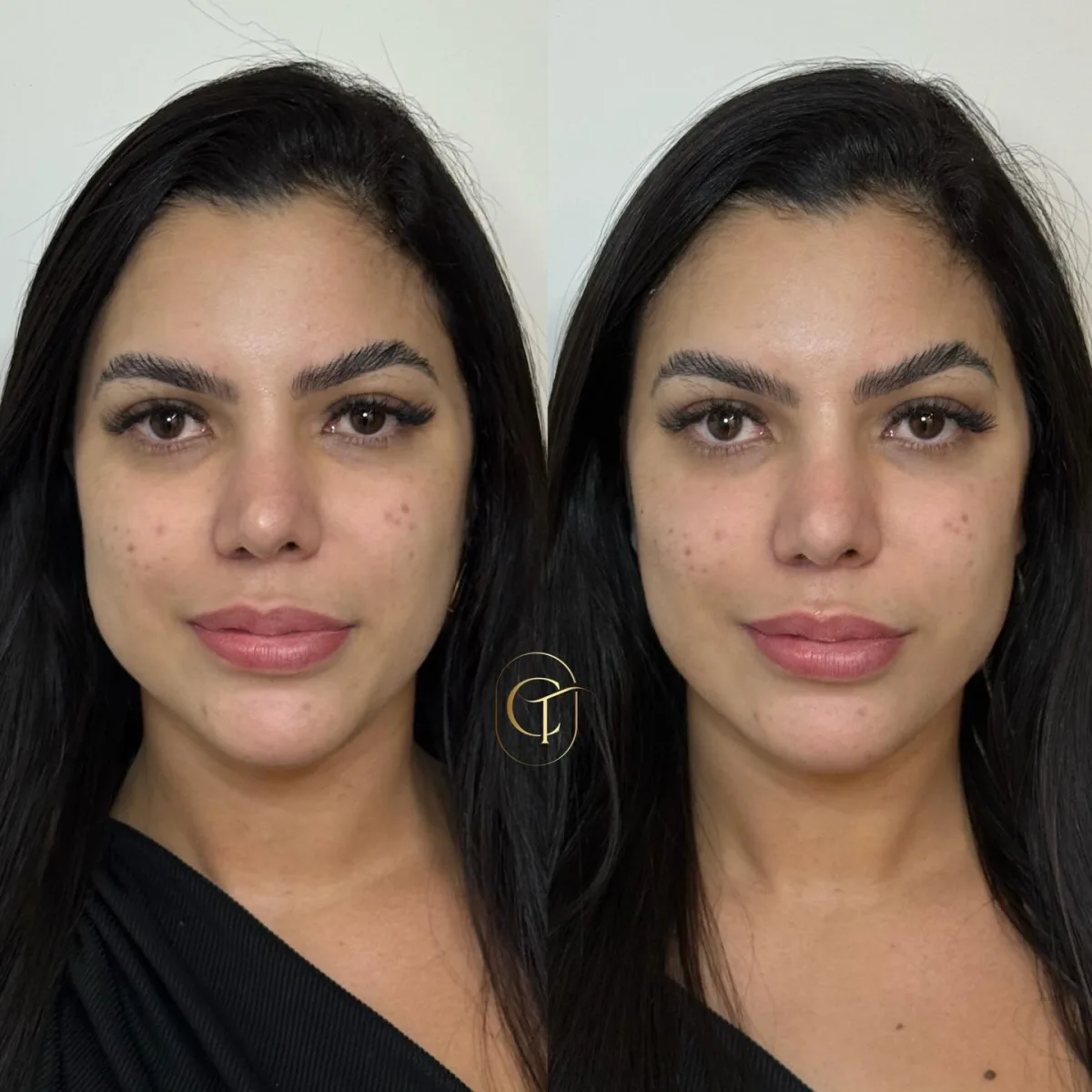 Refinar, harmonizar e respeitar a beleza natural