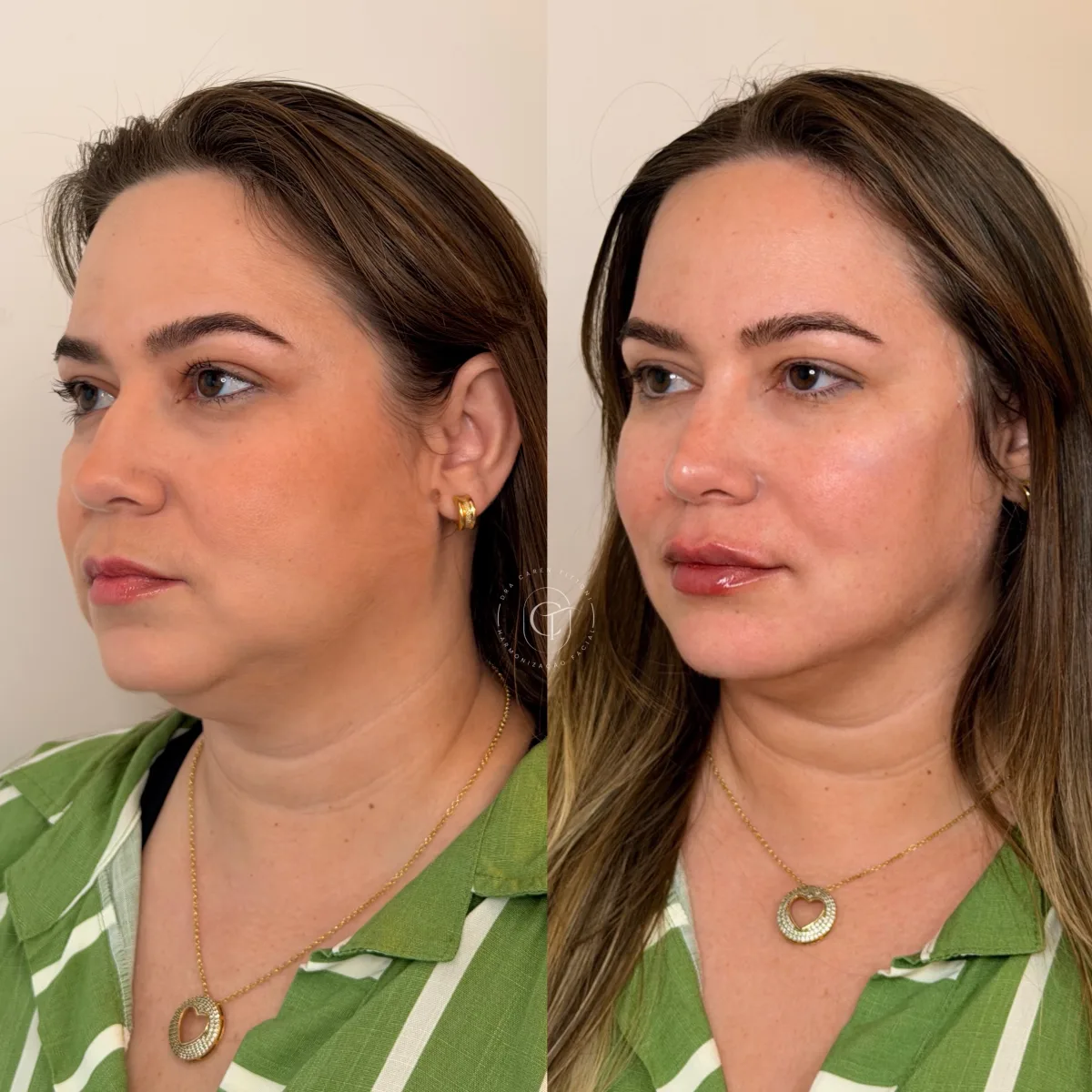 Cuidar da autoestima também é uma forma de recomeçar