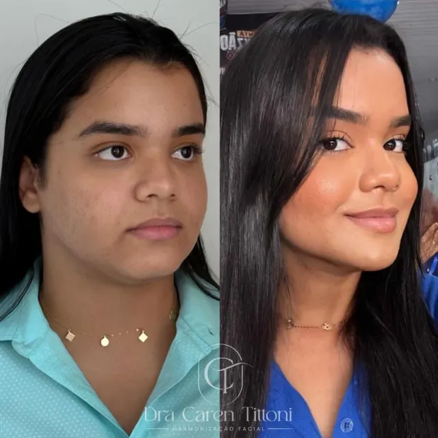 É óbvio que esse antes e depois tinha que vir pro feed! 🤌🏼✨

Ele deu o que fa...